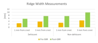 Ridge width measurements