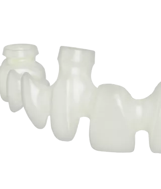 Procera implant bridge