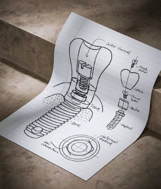 Nobel Biocare dental implant design