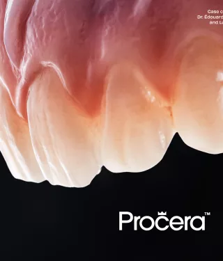 Procera restorations