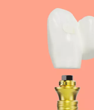 Multi-unit Abutment level N1 restorations