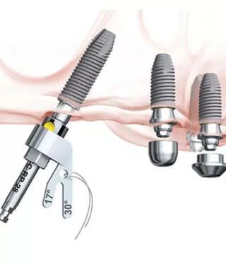 Multi-unit Aligning Instrument