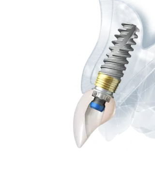Esthetic digital workflow