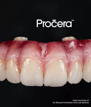 Procera™ restorations