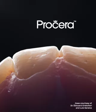 Procera restorations
