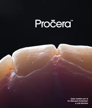 Procera