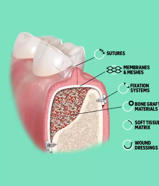 Full portfolio of regenerative solutions