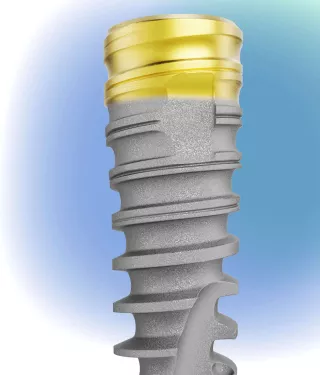 N1 implant