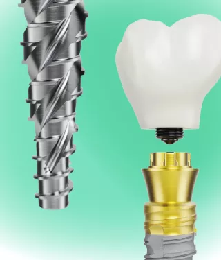 Nobel Biocare N1 system
