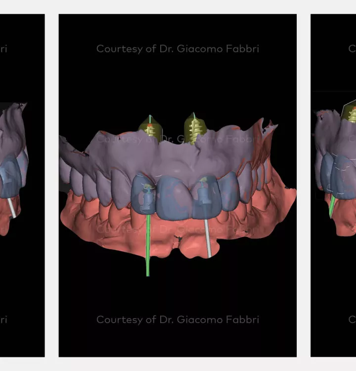 Case courtesy of Dr. Fabbri