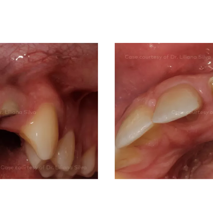 Case courtesy of Dr. Liliana Silva