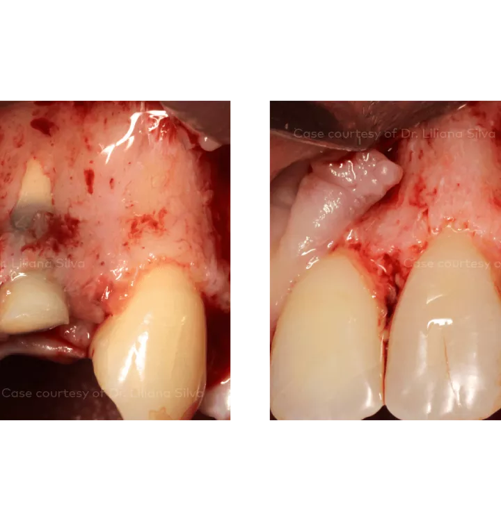 Case courtesy of Dr. Liliana Silva