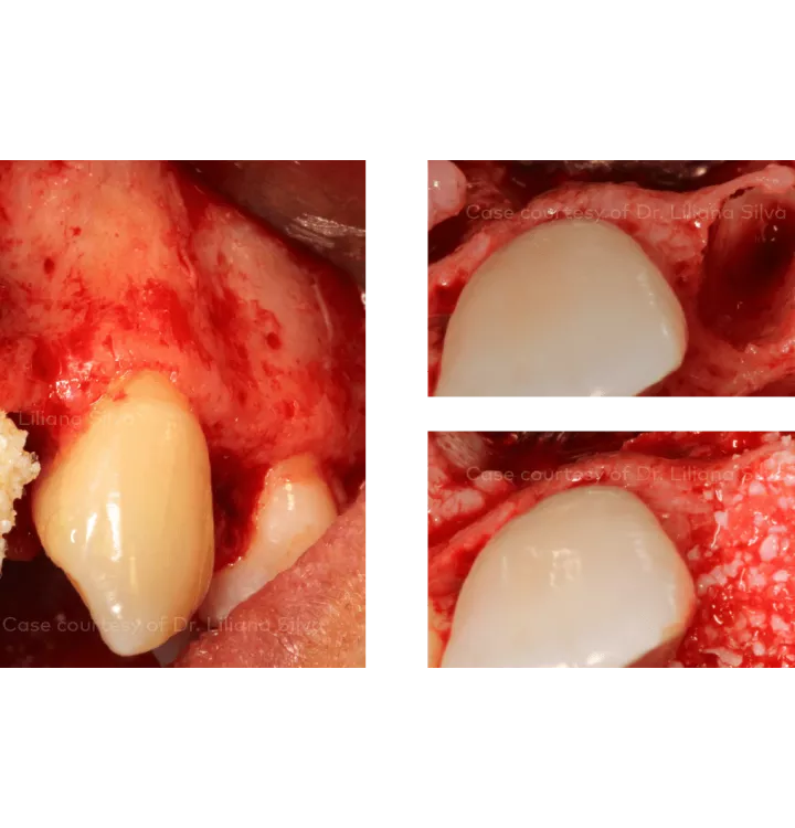 Case courtesy of Dr. Liliana Silva