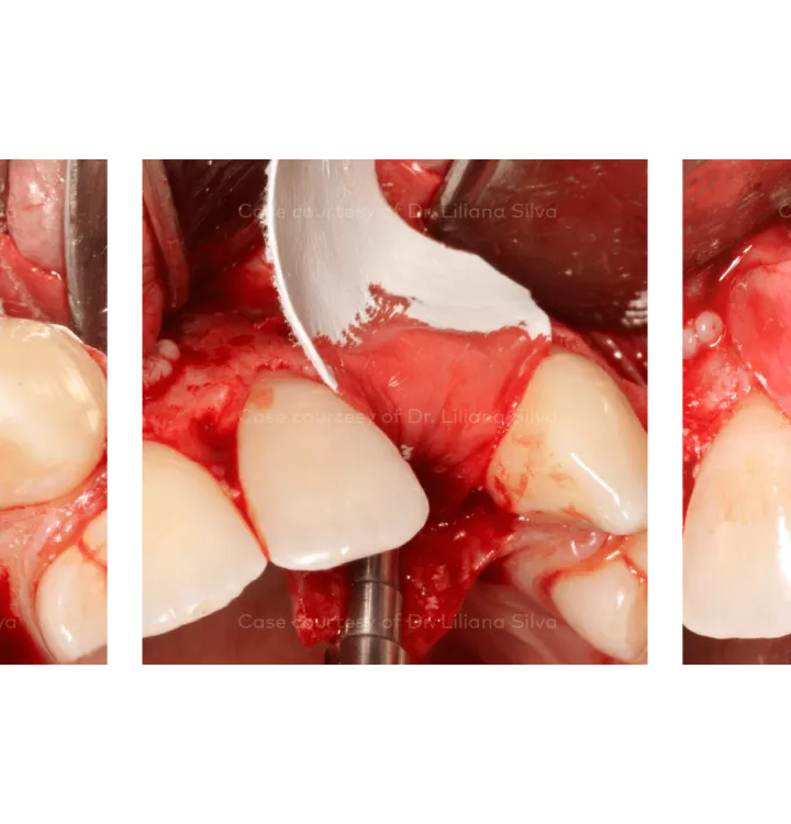 Case courtesy of Dr. Liliana Silva