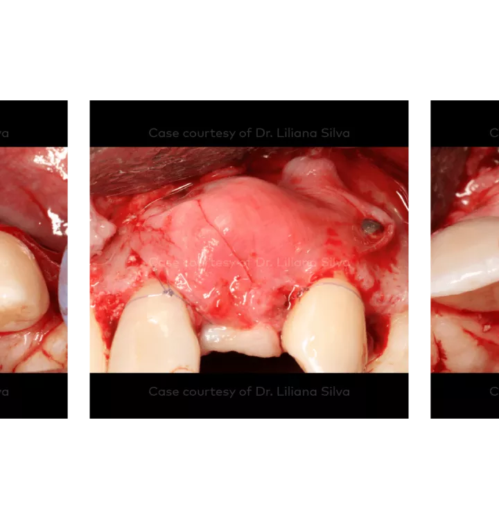 Case courtesy of Dr. Liliana Silva