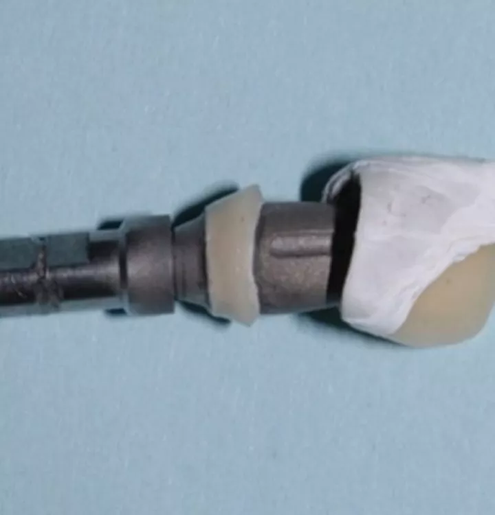 Further adapt the PTFE against the walls of the crown by gently placing the abutment. When complete, remove the abutment and make sure that the tape is even.