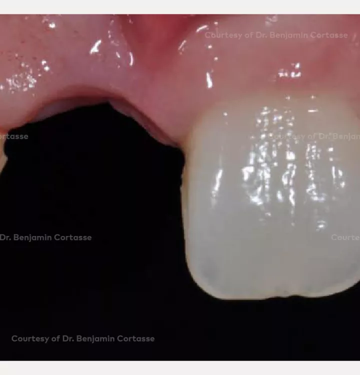 Case courtesy of Dr. Cortasse