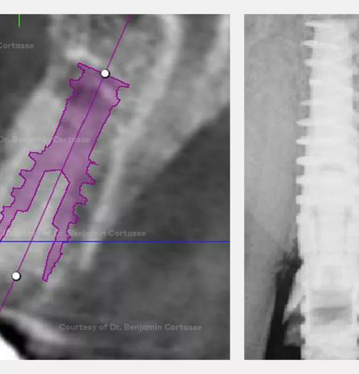 Case courtesy of Dr. Cortasse