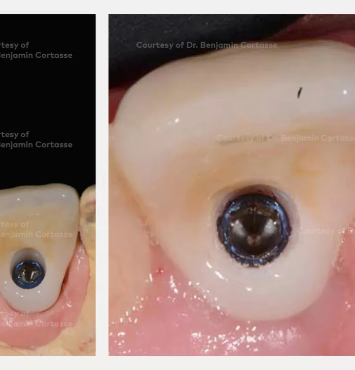 Case courtesy of Dr. Cortasse