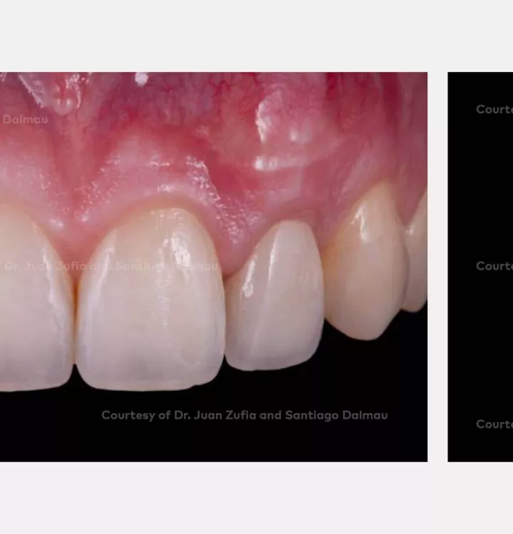 Case courtesy of Dr. Zufía and Dr. Dalmau