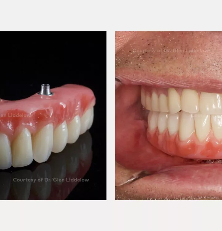 Case courtesy of Dr. Liddelow
