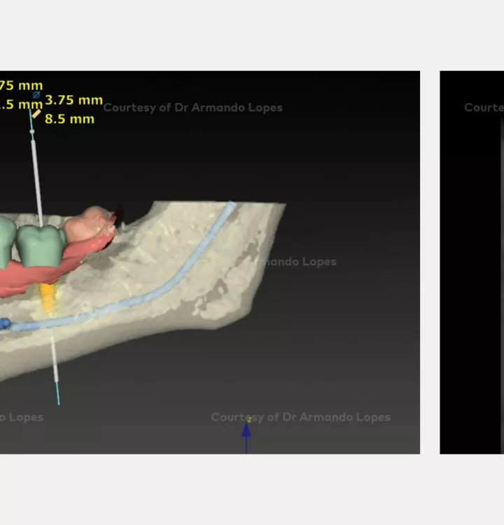 Case courtesy of Dr. Lopes