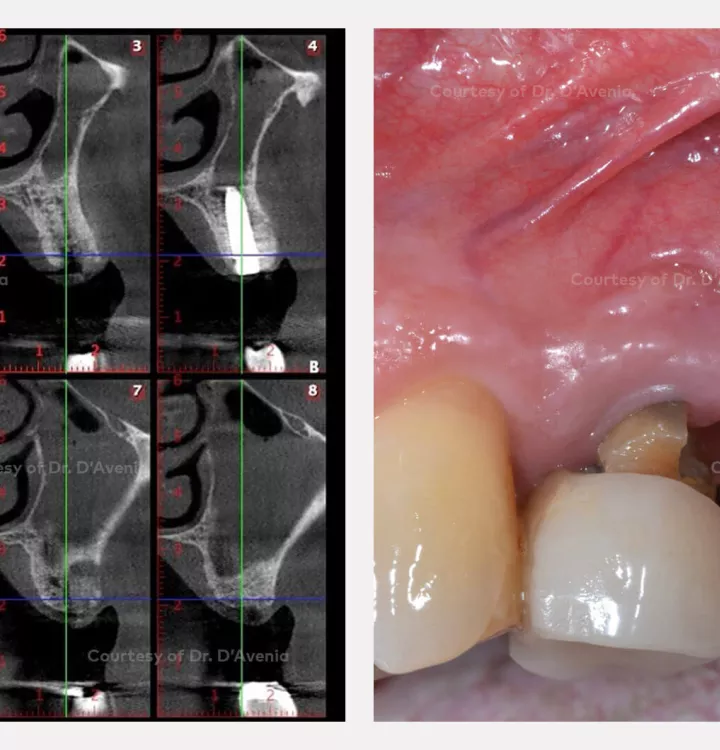 Case courtesy of Dr. D'Avenia