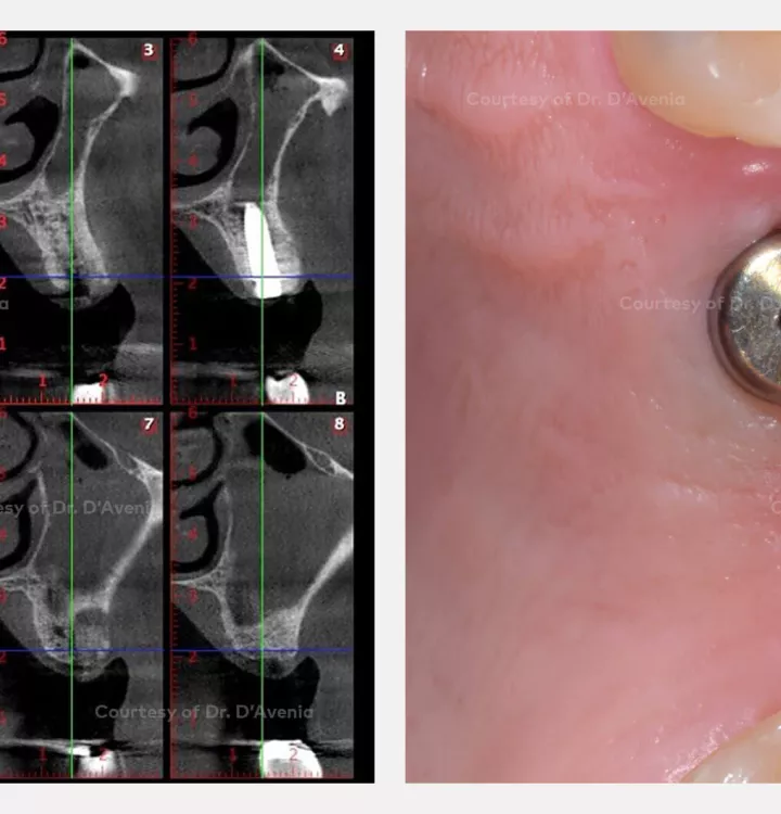 Case courtesy of Dr. D'Avenia