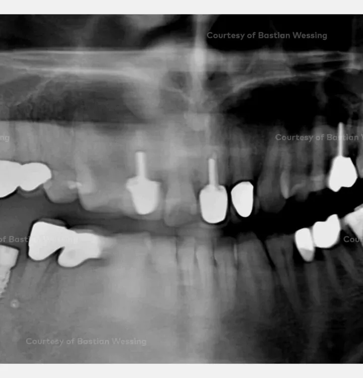 Case courtesy of Dr. Wessing