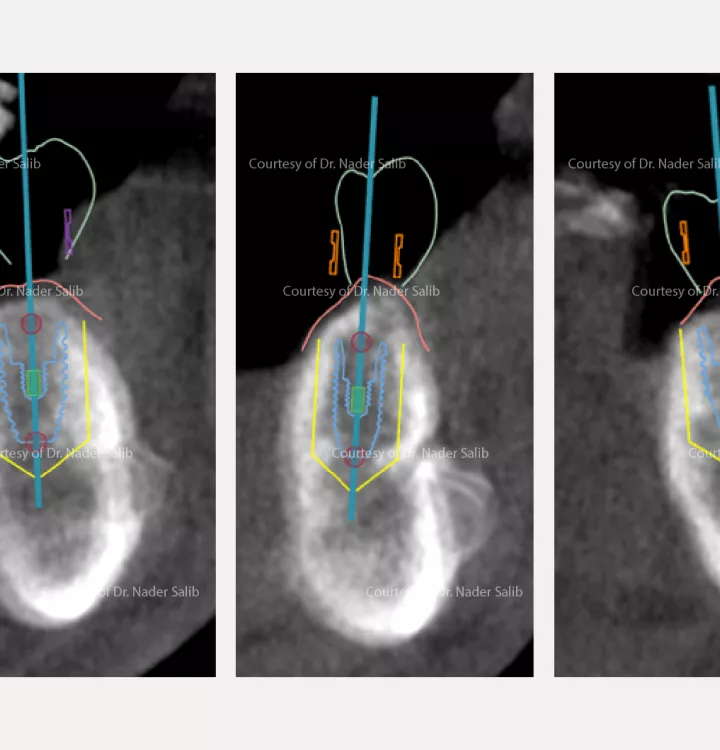 Case courtesy of Dr. Nader Salib