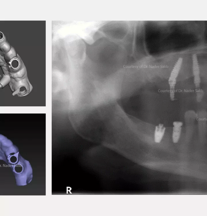 Case courtesy of Dr. Nader Salib