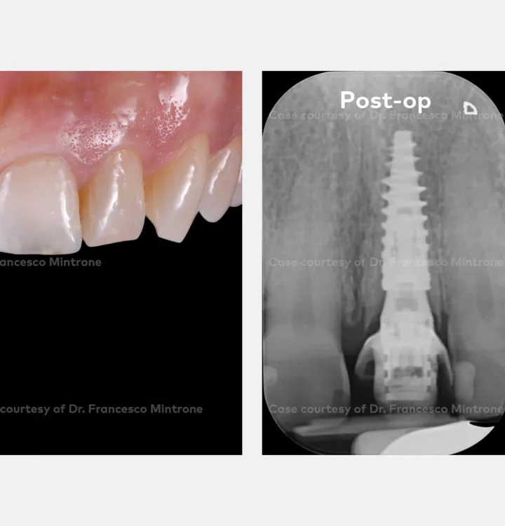 Case courtesy of Dr. Mintrone