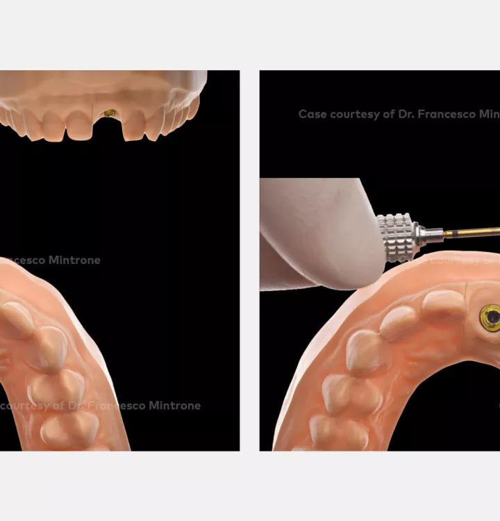 Case courtesy of Dr. Mintrone