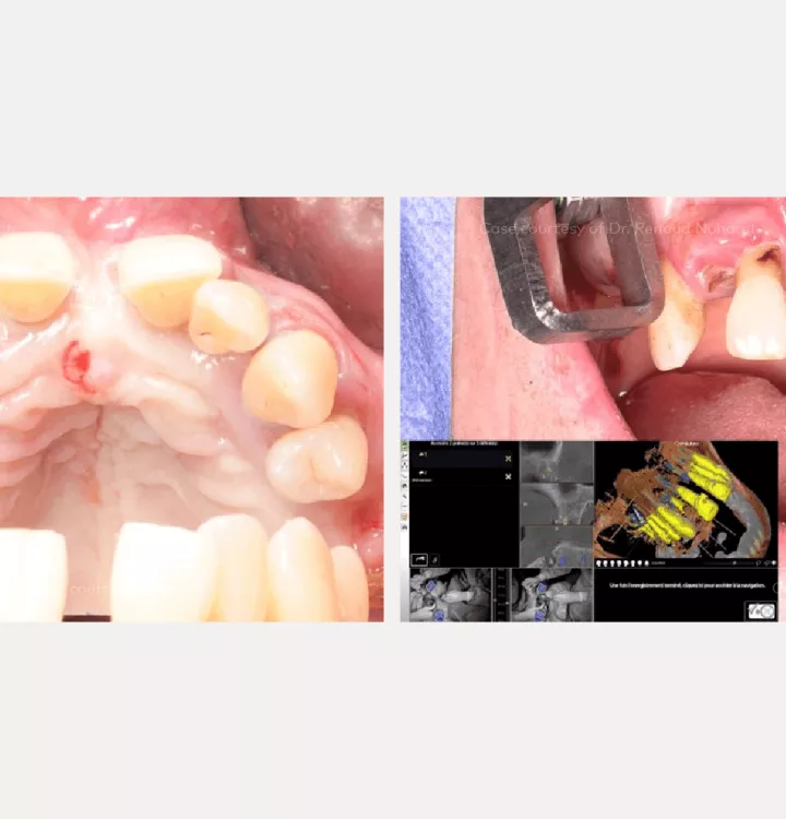 Case courtesy of Dr. Noharet