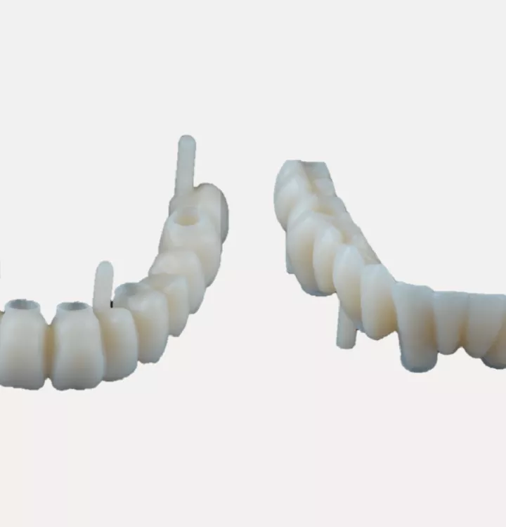 Case courtesy of Dr. Noharet
