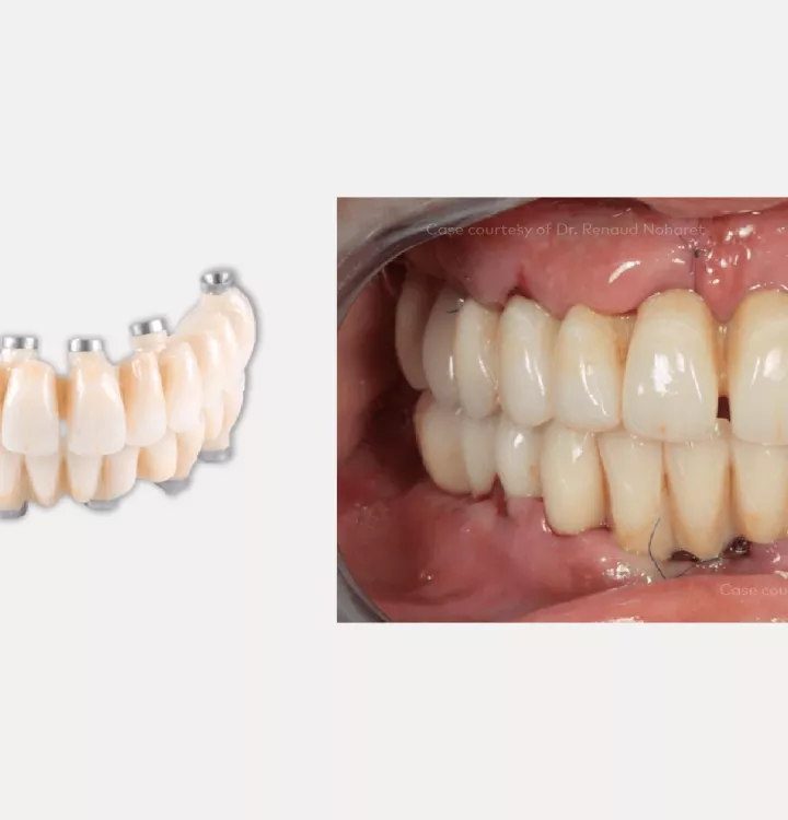 Case courtesy of Dr. Noharet