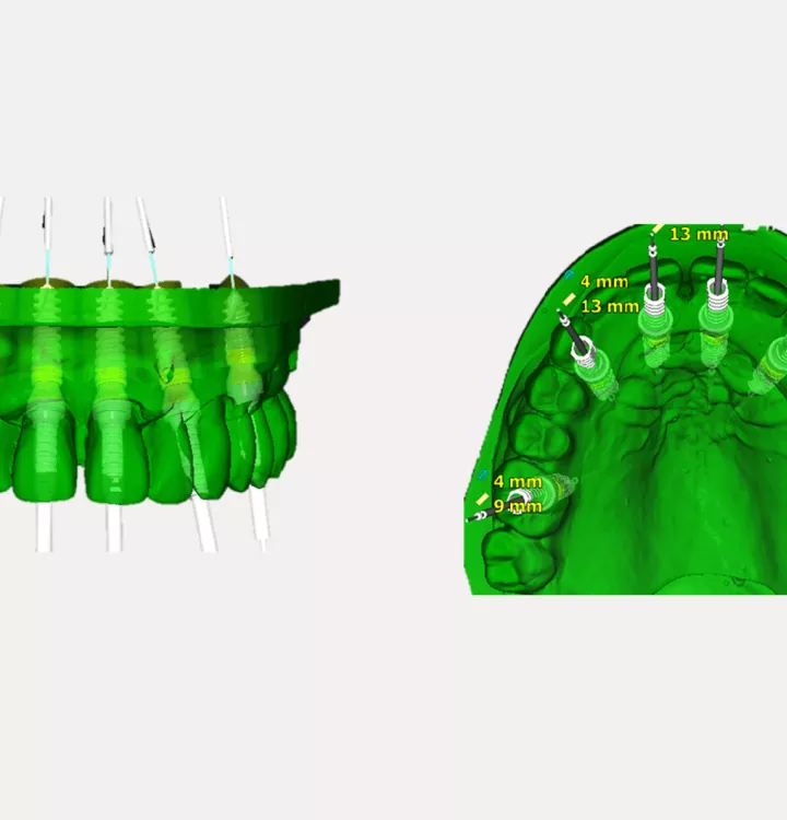 Case courtesy of Dr. Noharet