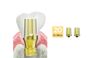 Esthetic abutments