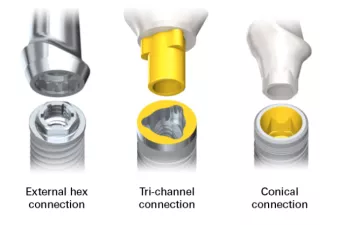 Connections