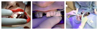 Case courtesy of Dr. Giacomo Fabbri
