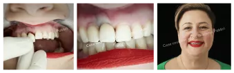 Case courtesy of Dr. Giacomo Fabbri