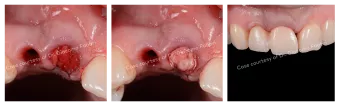Case courtesy of Dr. Giacomo Fabbri