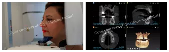 Case courtesy of Dr. Giacomo Fabbri