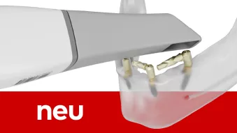 PoLo Multi-unit Abutment