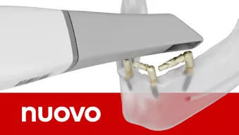 PoLo Multi-unit Abutment