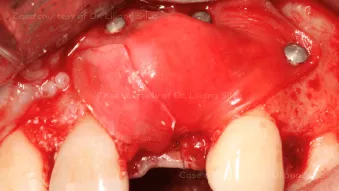 Case courtesy of Dr. Liliana Silva