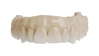 Implant bridges