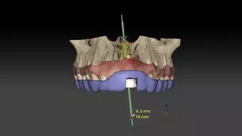 Courtesy of Drs. Todescan, Giugni and Hayashi