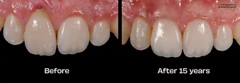 Case courtesy of Dr. Giacomo Fabbri