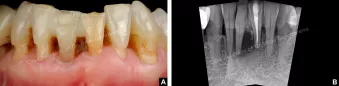 Case courtesy of Dr. Iñaki Gamborena